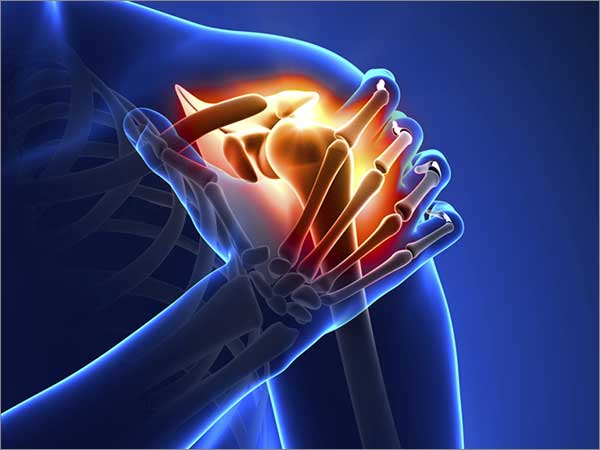 arthritis types and treatment in bangalore